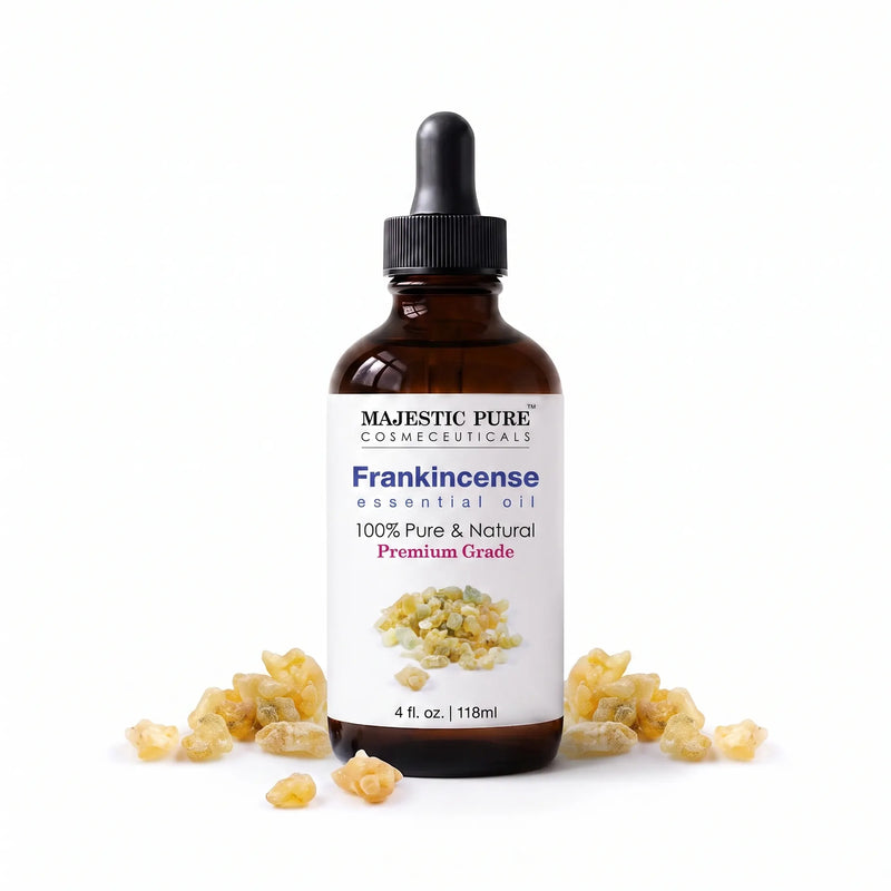 
  
    Frankincense Essential Oil | 100% Pure and Natural | 4 fl oz
  
