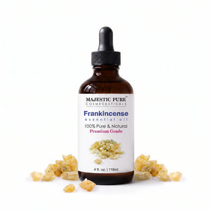 Frankincense Essential Oil | 100% Pure and Natural | 4 fl oz
