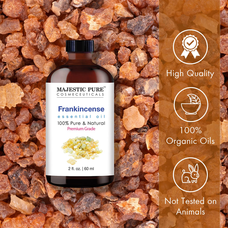 
  
    Frankincense Essential Oil | 100% Pure and Natural | 2 fl oz
  
