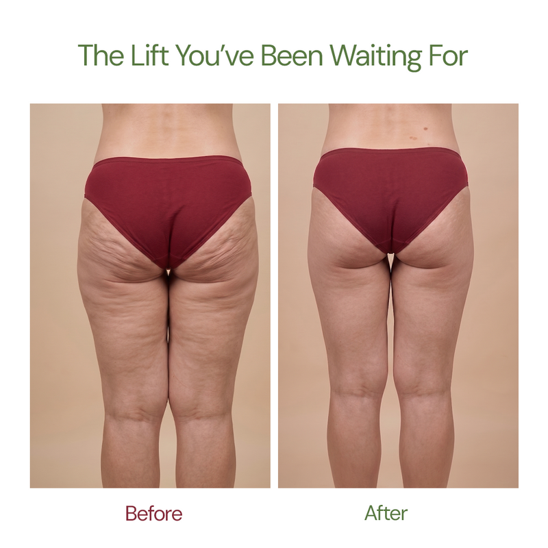 
  
    Vegan Collagen Cellulite Oil & Castor Oil — Body Sculpting and Circulation Support — Majestic Pure
  
